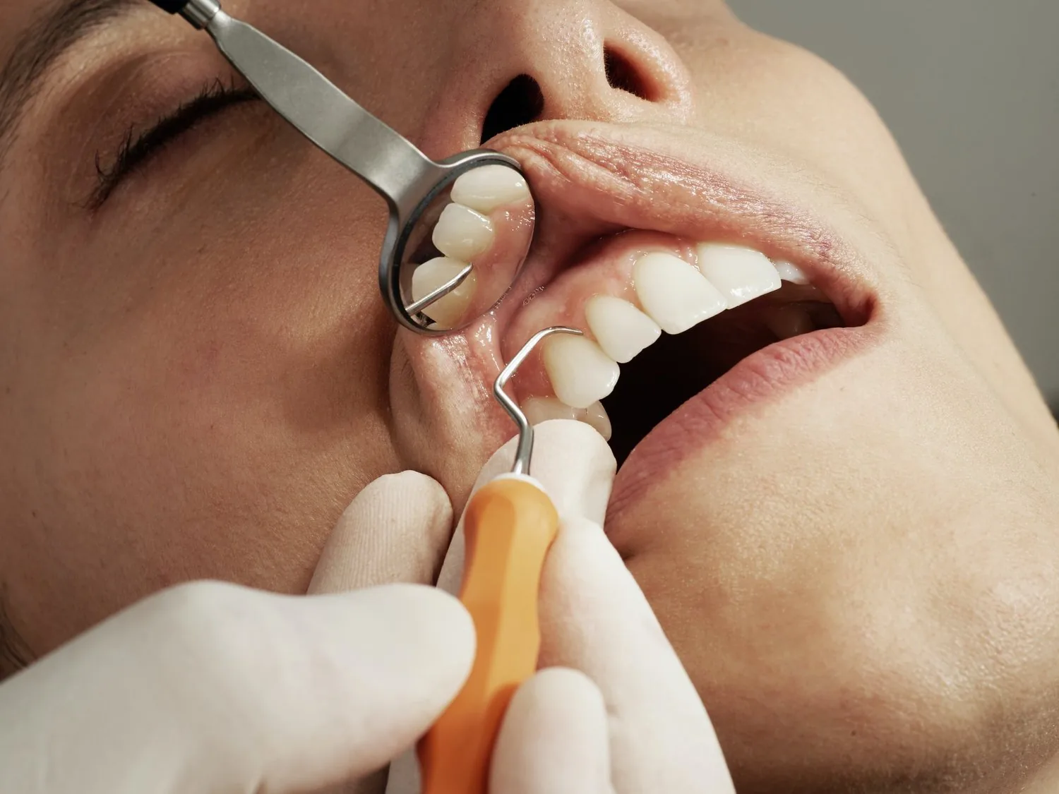 A dentist using a dental probe and mouth mirror to examine a patient's teeth.